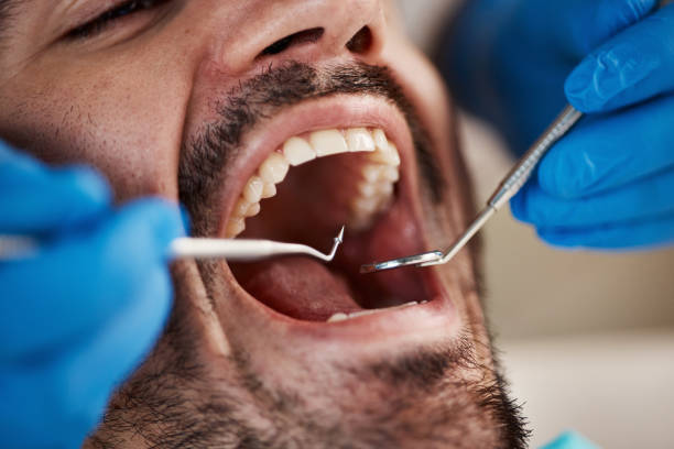 Best Emergency Dental Care for Abscessed Tooth in Choctaw, OK