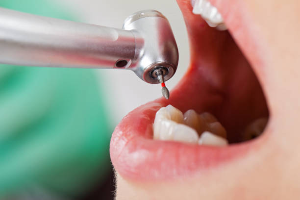  Choctaw, OK Emergency Dentist Pros
